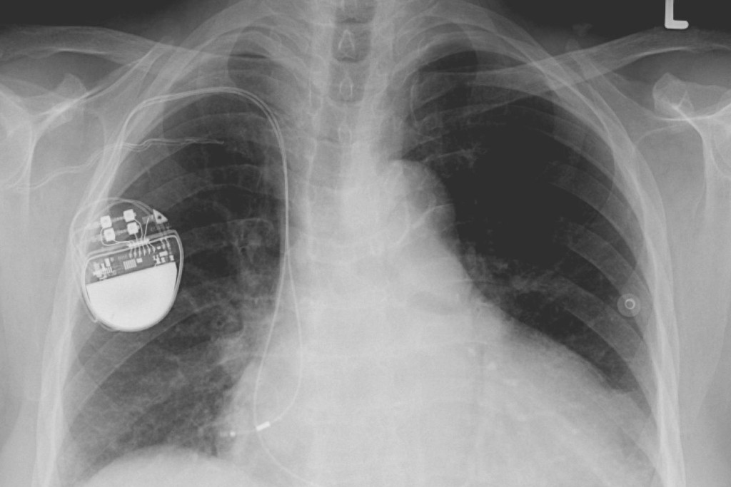 Health Canada issues cybersecurity guidance for medical devices